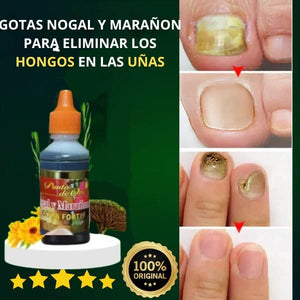 ROMPE HONGOS NOGAL Y MARAÑON - ELIMINA DEFINITIVAMENTE LOS HONGOS EN LAS UÑAS